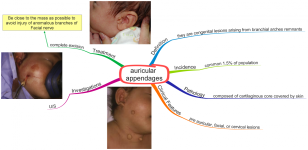 Click image for larger version  Name:	auricular appendages.png Views:	34 Size:	568.6 KB ID:	542
