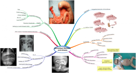 Click image for larger version  Name:	Jejunoileal Stenosis and Atresia2.png Views:	0 Size:	793.4 KB ID:	633