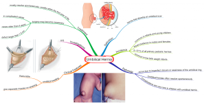 Click image for larger version  Name:	Umbilical Hernia.png Views:	57 Size:	671.1 KB ID:	744