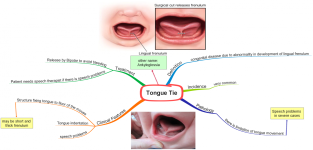 Click image for larger version  Name:	Tongue Tie.png Views:	54 Size:	528.6 KB ID:	765