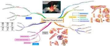 Click image for larger version  Name:	Meckel Diverticulum.png Views:	90 Size:	599.6 KB ID:	1073