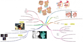 Click image for larger version  Name:	Intestinal Malrotation.png Views:	72 Size:	684.8 KB ID:	175