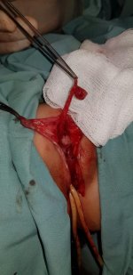 Click image for larger version Name: 3.jpg Views: 1 Size: 57.2 KB ID: 2048 Click image for larger version Name: 3.jpg Views: 1 Size: 57.2 KB ID: 2048