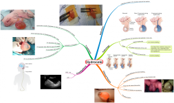 Click image for larger version  Name:	Hydrocele.png Views:	34 Size:	850.3 KB ID:	319