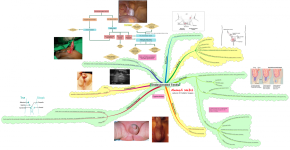 Undescended Testis.png
