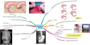 Click image for larger version  Name:	Duodenal Atresia.png Views:	53 Size:	650.1 KB ID:	435