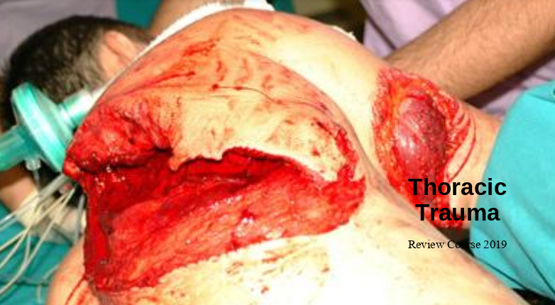 Click image for larger version

Name:	Capture.PNG
Views:	185
Size:	503.8 KB
ID:	387