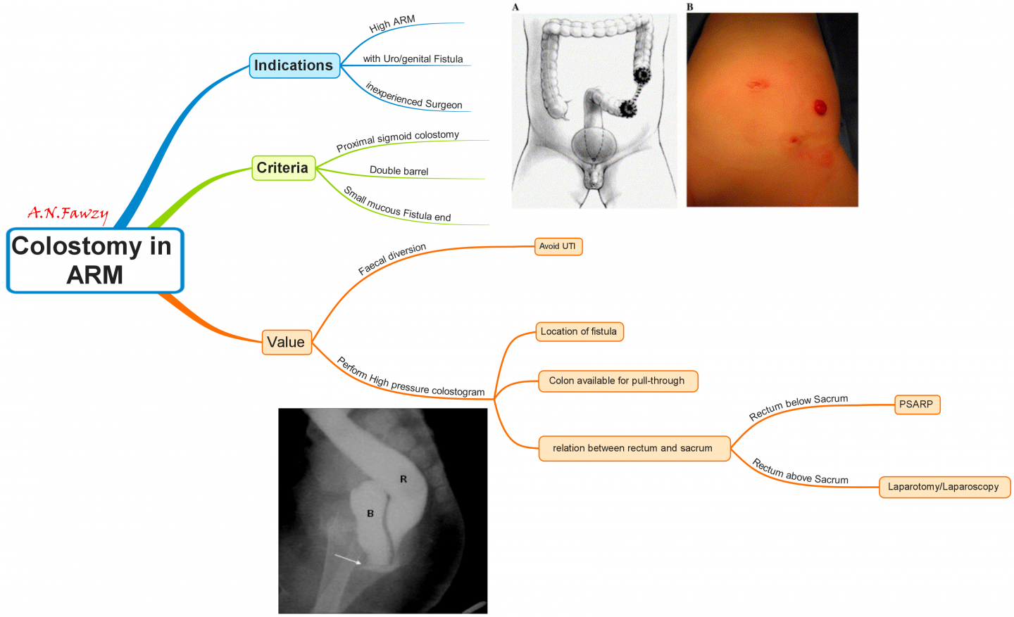 Click image for larger version  Name:	Colostomy in ARM.png Views:	39 Size:	674.9 KB ID:	437