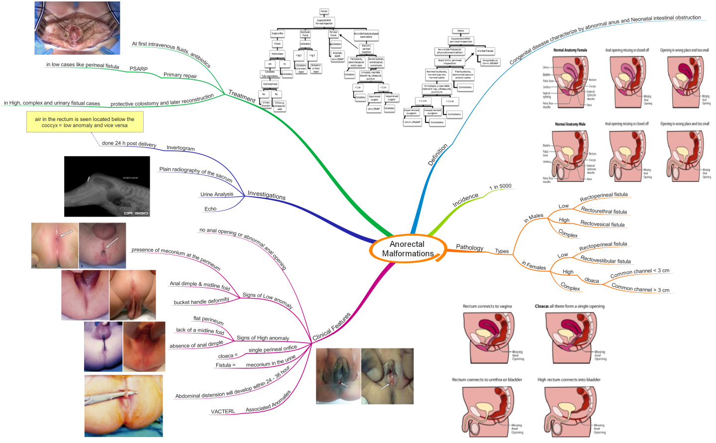 Click image for larger version  Name:	Anorectal Malformations.png Views:	113 Size:	887.8 KB ID:	767