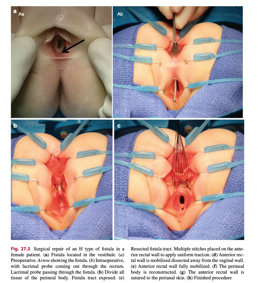 Click image for larger version

Name:	image_383.png
Views:	203
Size:	1.02 MB
ID:	2444