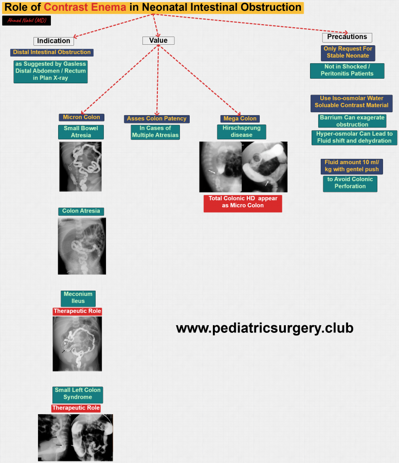 Click image for larger version

Name:	Contrast Enema.png
Views:	299
Size:	480.2 KB
ID:	2718