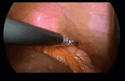 Click image for larger version

Name:	2021-04-28_11-46-13.gif
Views:	144
Size:	2.81 MB
ID:	3682