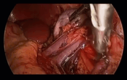Click image for larger version

Name:	2021-05-05_14-28-32.gif
Views:	107
Size:	3.27 MB
ID:	3737