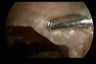 Click image for larger version

Name:	2021-05-08_8-53-09.gif
Views:	112
Size:	2.21 MB
ID:	3745