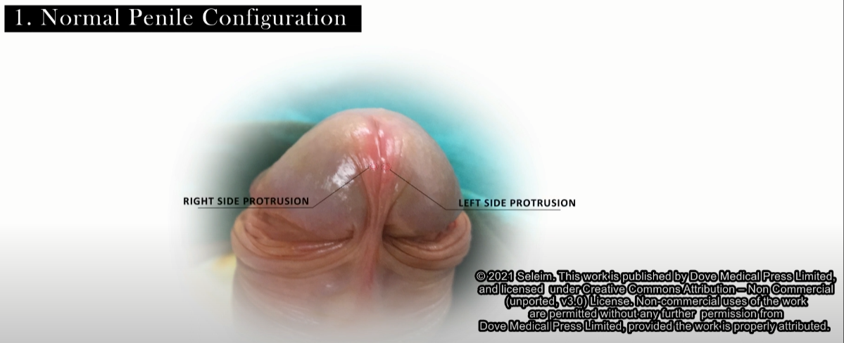 Click image for larger version

Name:	2022-05-06_12-55-18.png
Views:	116
Size:	341.6 KB
ID:	7952