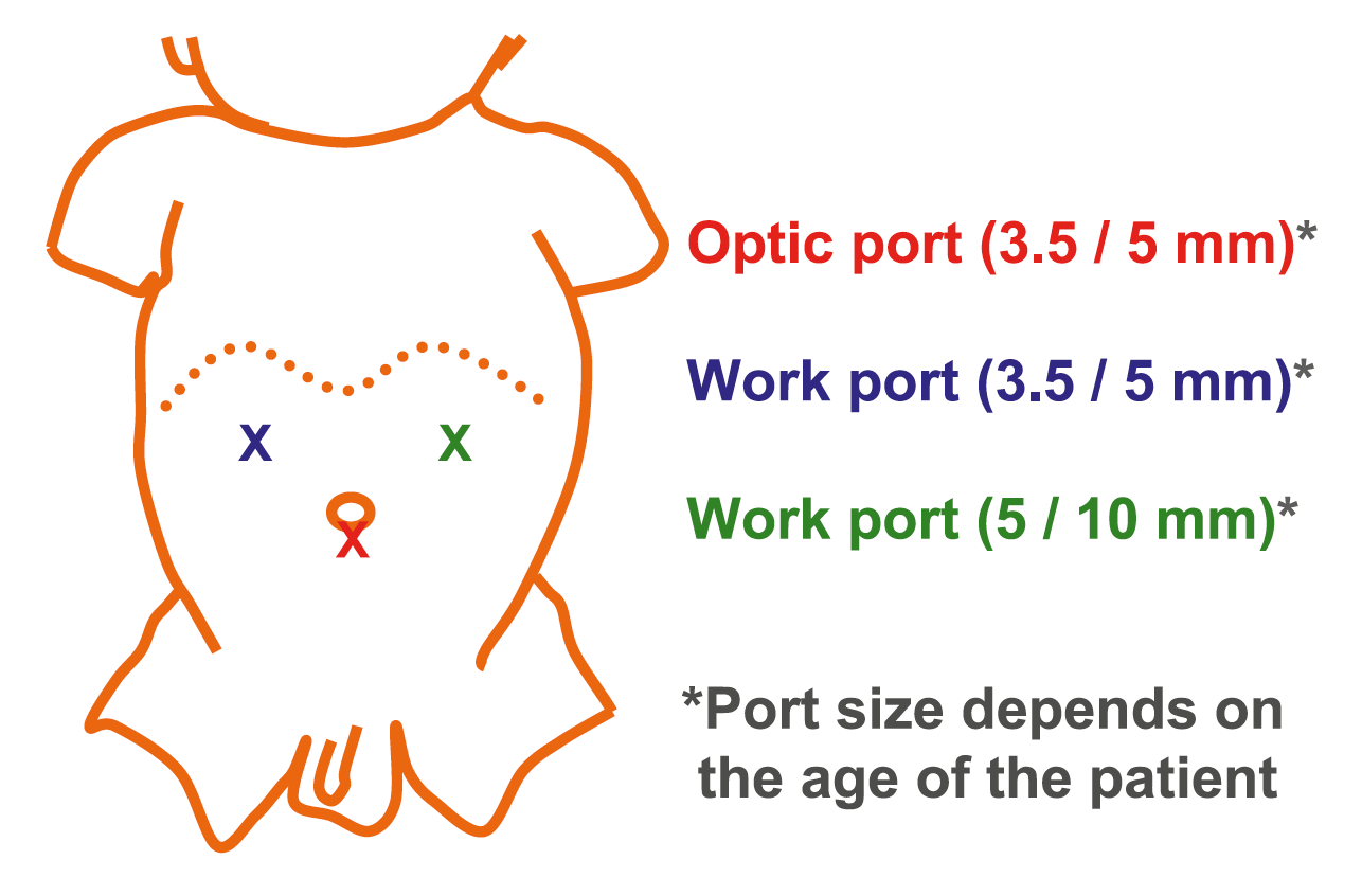 Click image for larger version

Name:	2022-05-12_02-46-23.png
Views:	68
Size:	89.3 KB
ID:	8176
